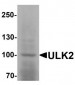 ULK2 Antibody (Internal)